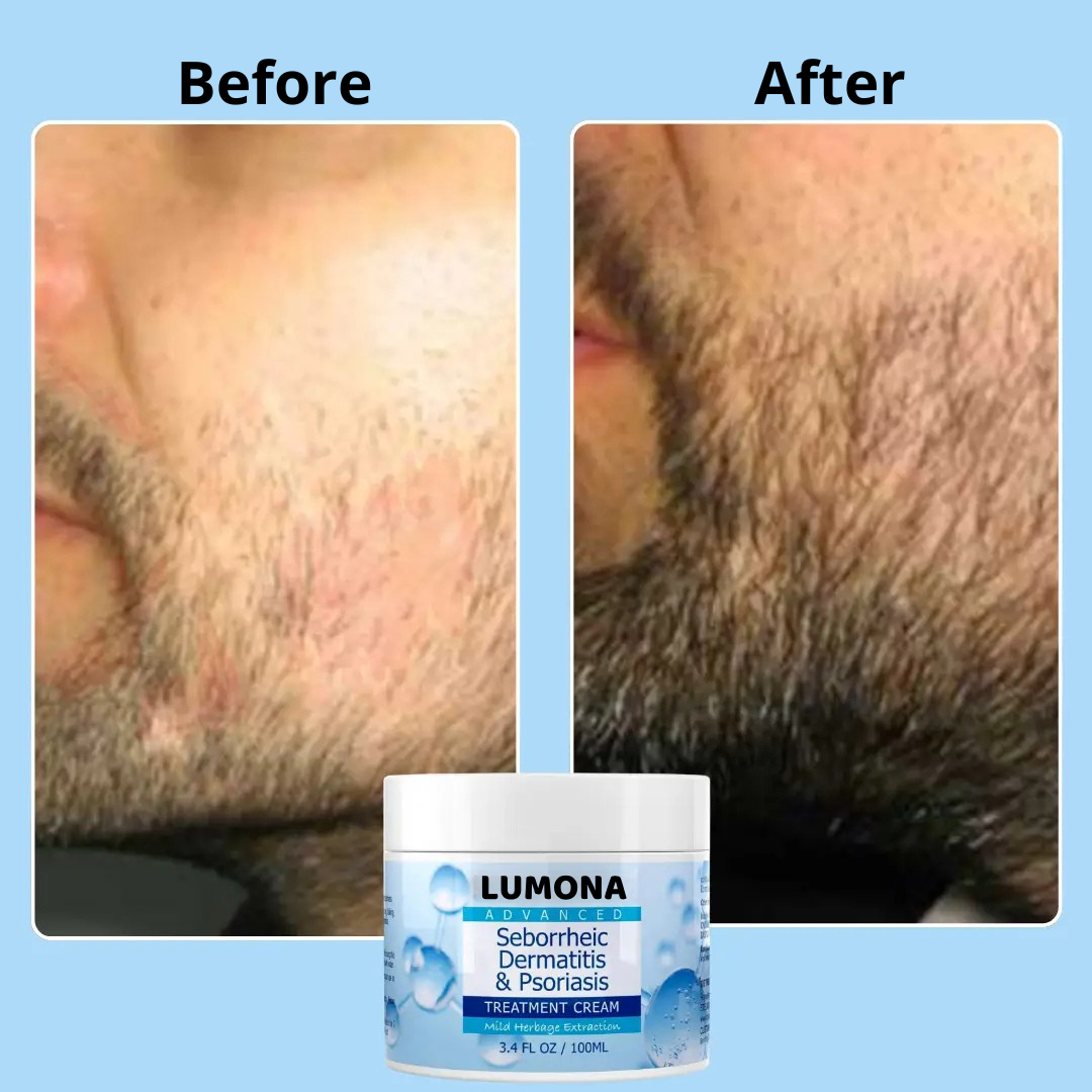 BeardRelief Cream